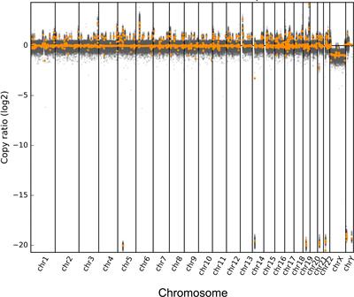 Case Report: Mycobacterium kansasii causing infective endocarditis explored by metagenomic next-generation sequencing